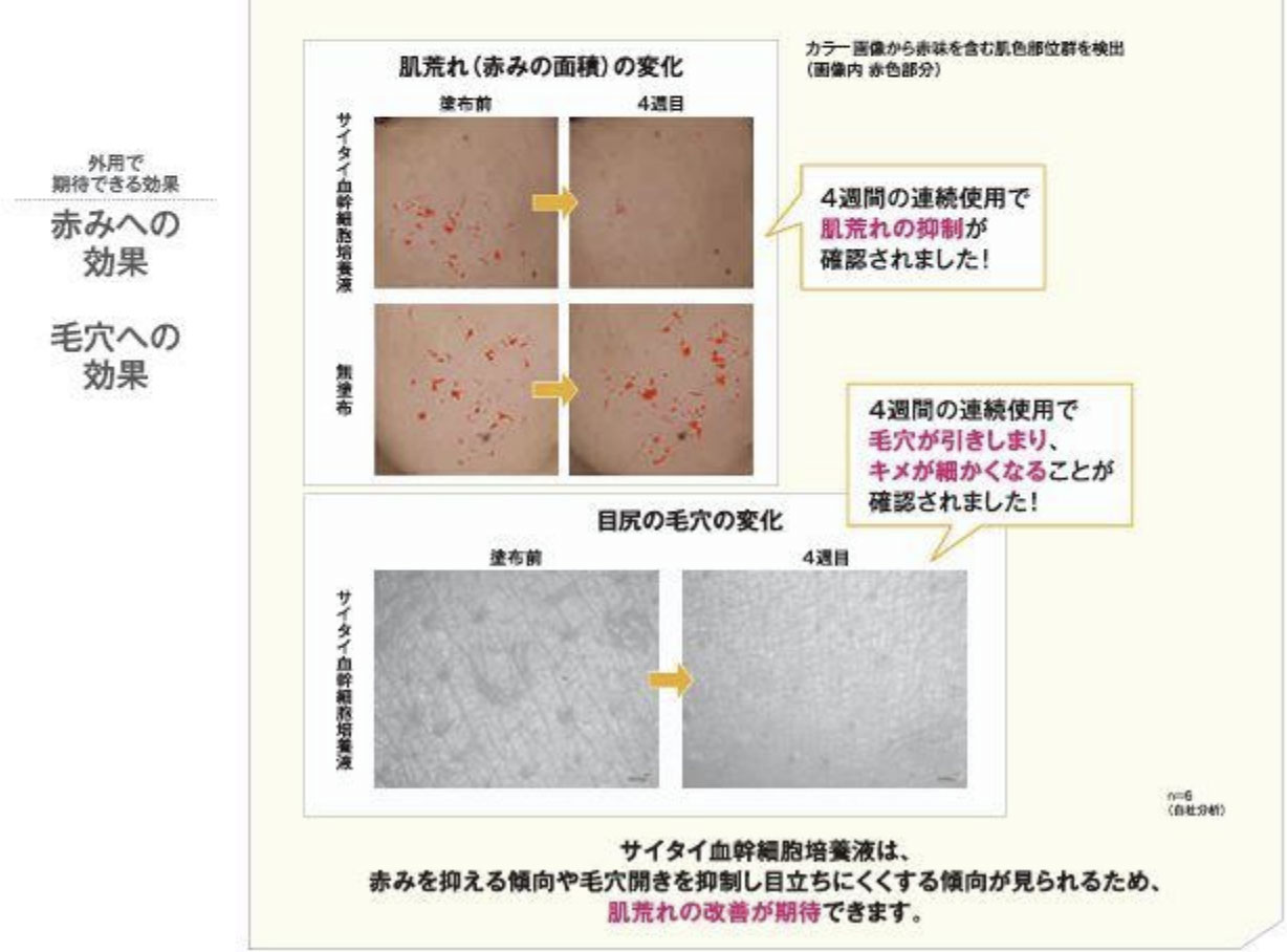 サイタイ血幹細胞培養液の傷を修復する作用とコラーゲン増殖作用